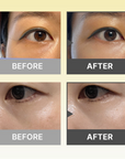 Bakuchiol Dual Vita Eyecream
