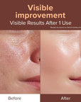 ID EXO-V® BOOSTER AMPOULE