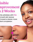YADAH COLLAGEN HYDRA FIRST ESSENCE