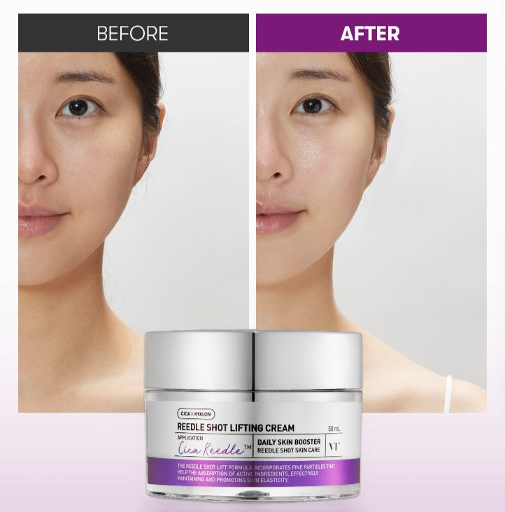 VT REEDLE SHOT LIFTING CREAM