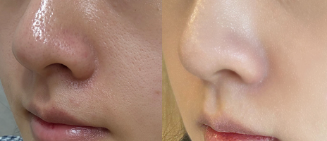 CELLOLOGY PURPLE CARROT PORE AMPOULE