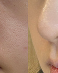 CELLOLOGY PURPLE CARROT PORE AMPOULE