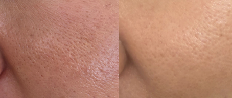 CELLOLOGY PURPLE CARROT PORE AMPOULE
