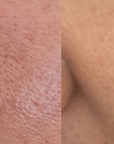 CELLOLOGY PURPLE CARROT PORE AMPOULE