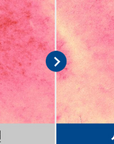 CELLOLOGY BLUE ERASER SERUM