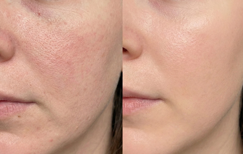 DDALMOMDE CHAGA CICA GLOW EXOSOME CREAM