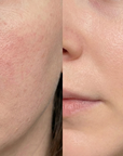 DDALMOMDE CHAGA CICA GLOW EXOSOME CREAM
