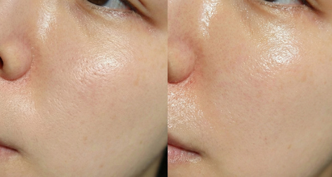 DDALMOMDE CHAGA CICA GLOW EXOSOME CREAM