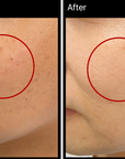 MIRACLETOX Camellia Brightening Ampoule