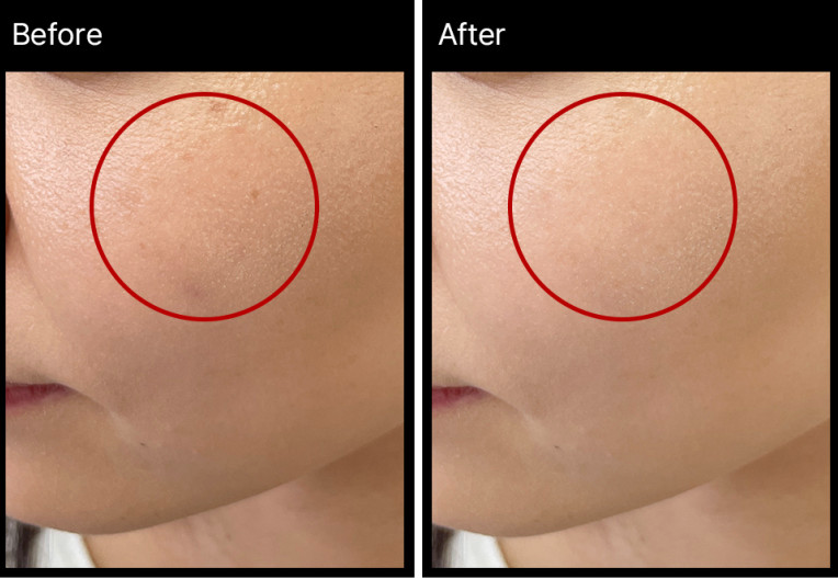 MIRACLETOX Camellia Brightening Ampoule
