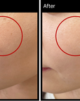MIRACLETOX Camellia Brightening Ampoule