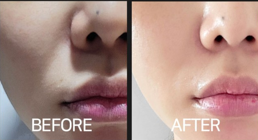CELLVIO DOLDORI ELECDERMA ROLL MASK (1ea)