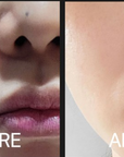 CELLVIO DOLDORI ELECDERMA ROLL MASK (1ea)