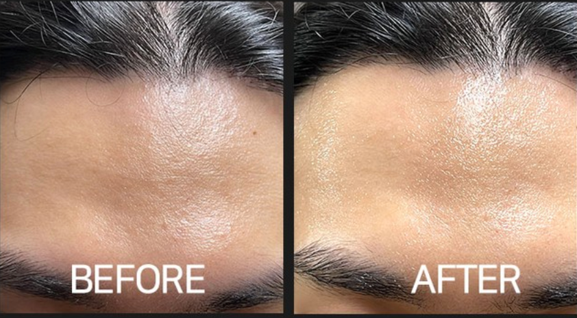 CELLVIO DOLDORI ELECDERMA ROLL MASK (1ea)