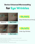 VT PDRN Reedle Shot Eye Lifter Cream