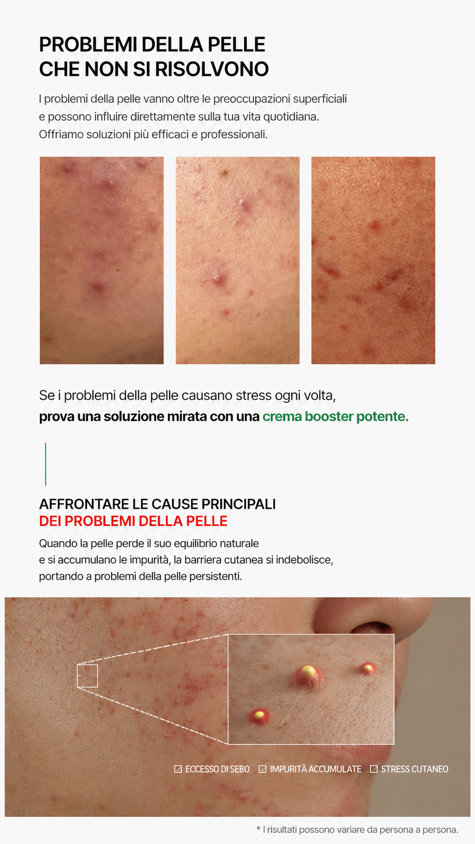 VEMONTES AXCNE BOOSTER CREAM 25ml
