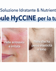 VEMONTES HYCCINE AMPOULE KIT