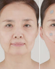 idPLACOSMETICS FACE FIT PLUS PATCH V3 (4 pezzi)